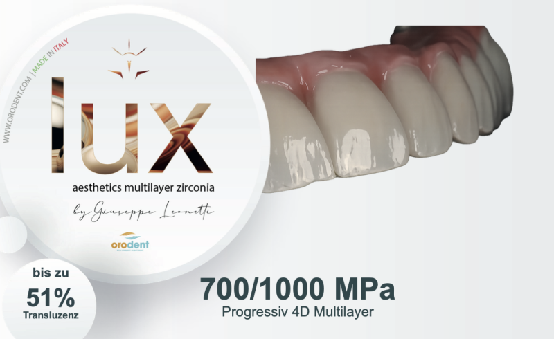 Lux aesthetics multikayer zirconia 700/1000MPa Verfügbare Farben A0-A1-A2-A3  Verfügbare Höhen 14-16-18-20 mm